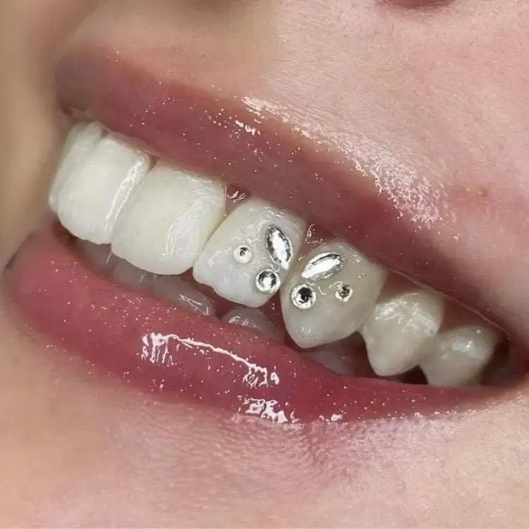 Images Salon Suites - teeth gems, butterfly - Fairview Heights, IL