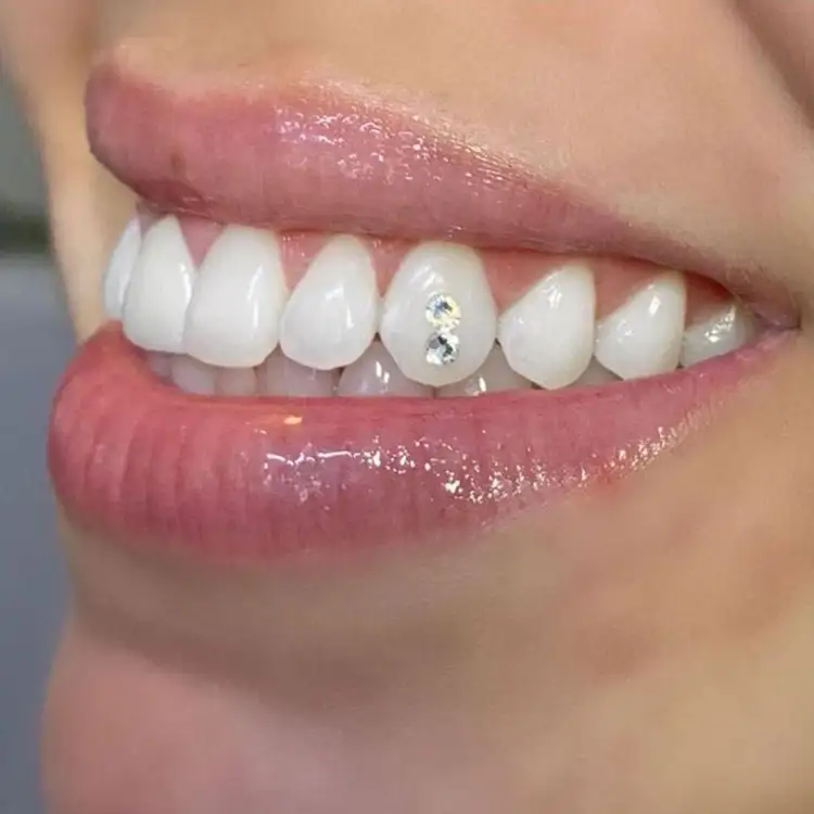 Images Salon Suites - teeth gems - Fairview Heights, IL