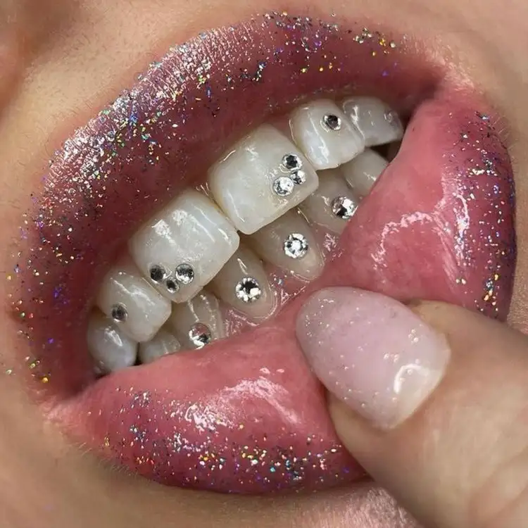 Images Salon Suites - teeth gems - Fairview Heights, IL