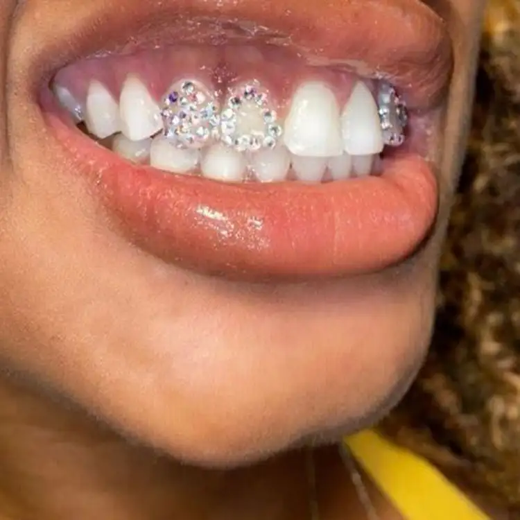 Images Salon Suites - teeth gems - Fairview Heights, IL