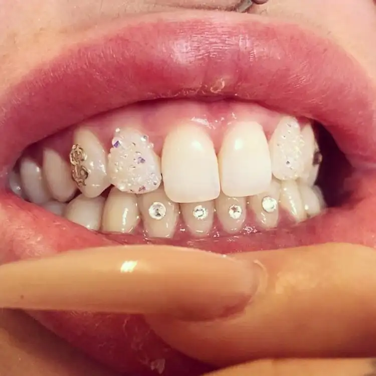 Images Salon Suites - teeth gems - Fairview Heights, IL