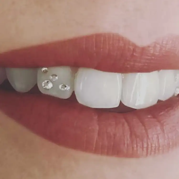 Images Salon Suites - teeth gems - Fairview Heights, IL
