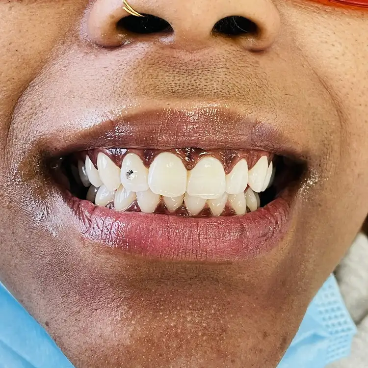 Images Salon Suites - teeth gems - Fairview Heights, IL