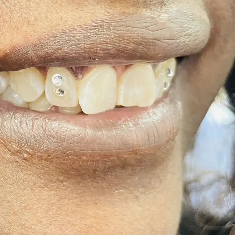 Images Salon Suites - teeth gems - Fairview Heights, IL